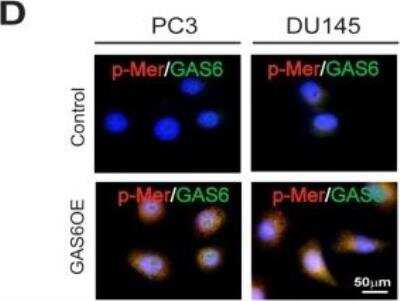 Immunocytochemistry/ Immunofluorescence: Mer [p Tyr754, p Tyr749, p Tyr753] Antibody [NB300-690]